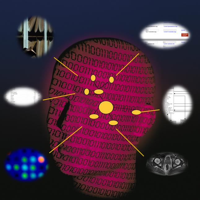 XplOit Schema.