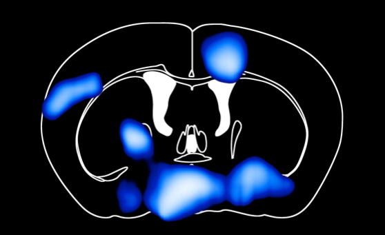 Querschnitt durchs Mausgehirn: Regionen mit reduzierter Glukoseaufnahme nach drei Tagen fettreicher Ernährung (blau: schwach reduziert, weiß: stark reduziert)