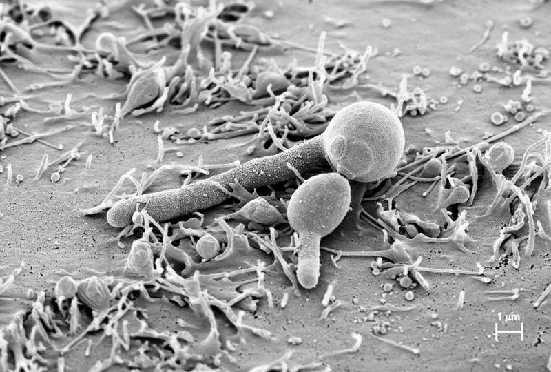 Candida albicans hat sich als Hefezelle auf Mundschleimhaut angeheftet und eine Hyphe gebildet. Sie produziert dabei das jetzt von einem deutsch-britischen Forscherteam gefundene Toxin Candidalysin.