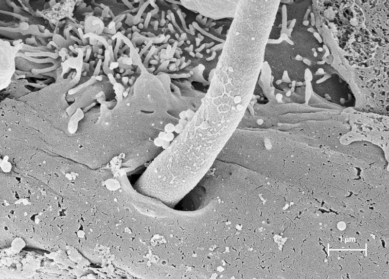 Eine von Candida albicans gebildete fadenförmige Hyphe dringt in eine Mundschleimhautzelle ein. Sie bildet dabei das Toxin Candidalysin, wie ein internationales Forscherteam jetzt zeigen konnte.