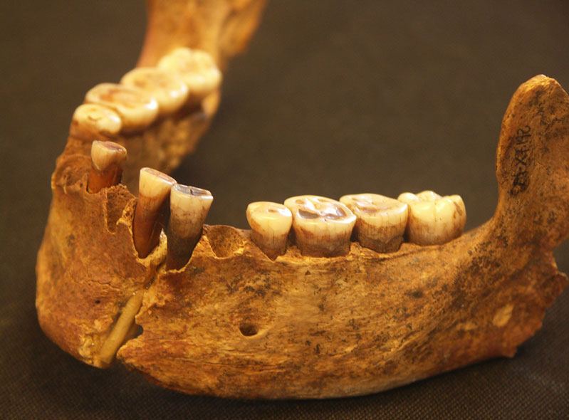 Unterkiefer der 19.000 Jahre alten “Roten Lady aus der El Mirón Höhle“ im Norden Spaniens. 