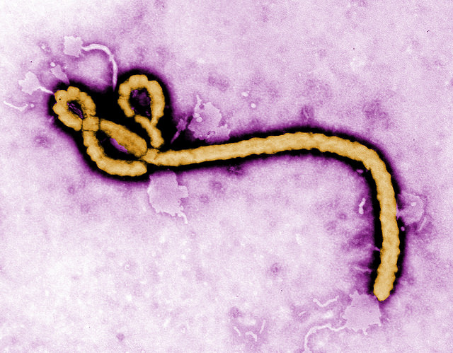 Gefürchtet: das Ebola-Virus