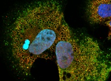 ABHD5 (grün) auf der Oberfläche von Lipid Droplets in einer menschlichen Leberzelle.