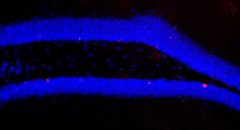 Der Hippocampus nach Behandlung mit Antibiotika unter dem Mikroskop: nur wenige neue Zellen (rot) werden gebildet.