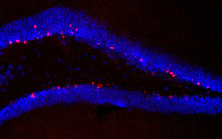 Der Hippocampus von unbehandelten Tieren, die trainiert haben: Zahlreiche Zellen bilden sich neu (rot markiert).
