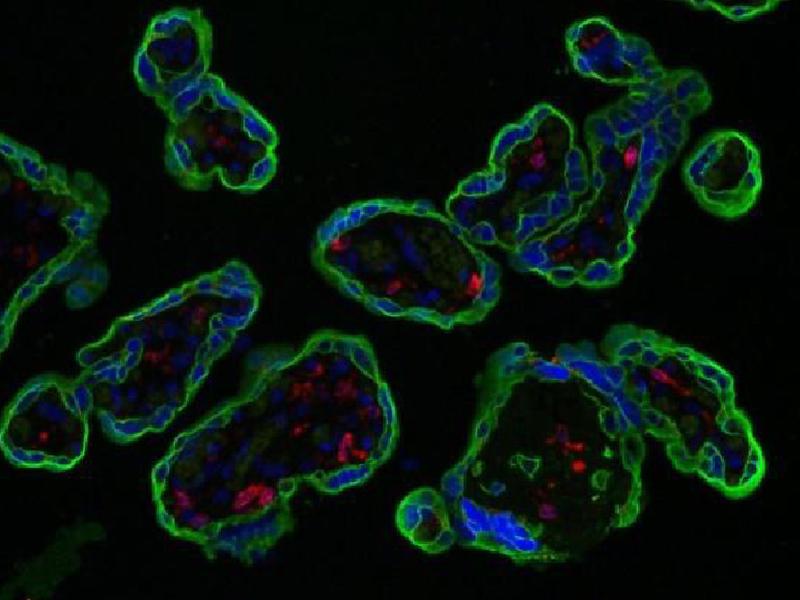 CD74 (rot markiert) ist auf gesunden Makrophagen präsent. Die Trophoblasten der Plazenta sind grün angefärbt.