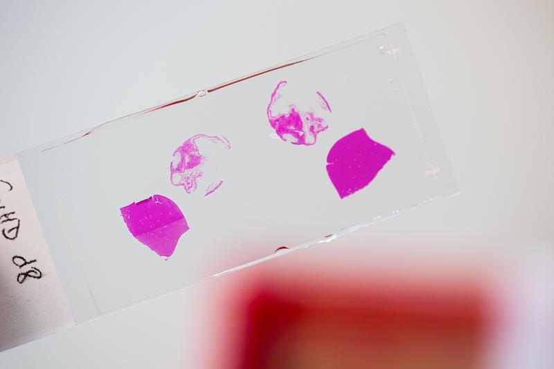 Objektträger mit eingefärbten Fragmenten von Leber und Darm zur Detektion einer zellulären Abstoßungsreaktion nach Knochenmarktransplantation.