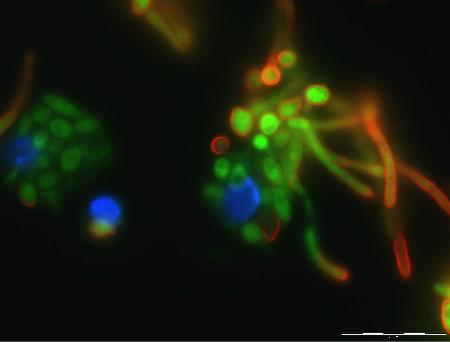 Candida albicans (in grün) wird von der Dendritischen Zelle (in blau) gefressen. Eine andere Dendritische Zelle wird jedoch von dem Hefepilz getötet, indem seine Pilzfäden 