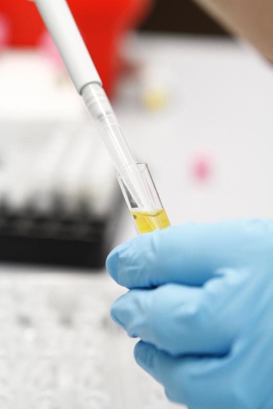 Das Kommen und Gehen von Antikörpern kann verraten, wie schnell Kinder an Typ-1-Diabetes erkranken. 