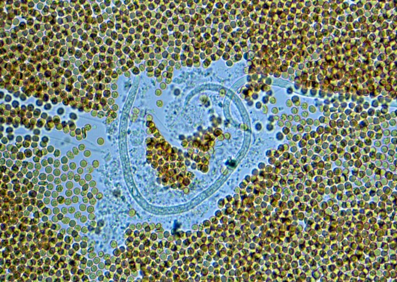 Wurmlarve von Wuchereria bancrofti