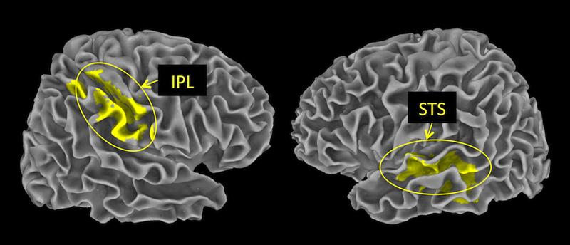 Der sogenannte Lobus parietalis inferior (IPL) im Scheitellappen bewertet negative, der Sulcus temporalis superior (STS) im Schläfenlappen interpretiert positive Ereignisse. 