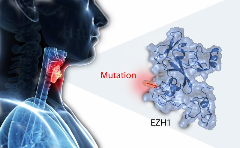 Eine Mutation in dem EZH1-Gen IST der zweithäufigste genetische Defekt in autonomen Adenomen. Dies haben Wissenschaftler der Uni Würzburg jetzt gezeigt.