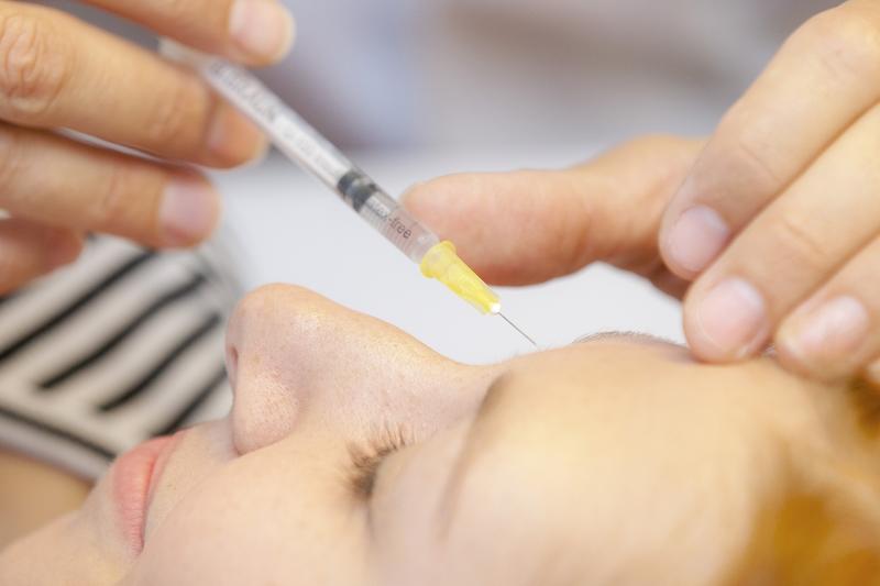 Botulinumtoxin wird in die Stirn gespritzt.   