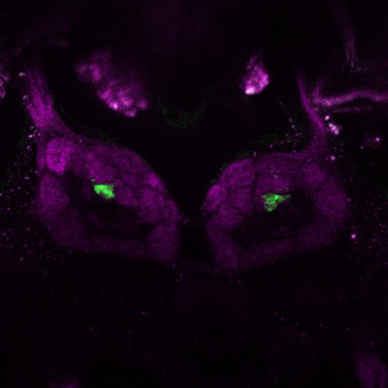 Fluoreszenzmikroskopische Aufnahme des Antennallobus, dem Riechhirn einer Essigfliege (Drosophila melanogaster): Die kugelförmigen Gebilde sind die sogenannten olfaktorischen Glomeruli.