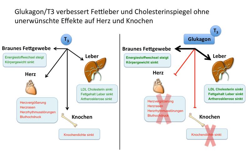 Glukagon/T3 verbessert Fettleber und Cholesterinspiegel ohne unerwünschte Effekte auf Herz und Knochen