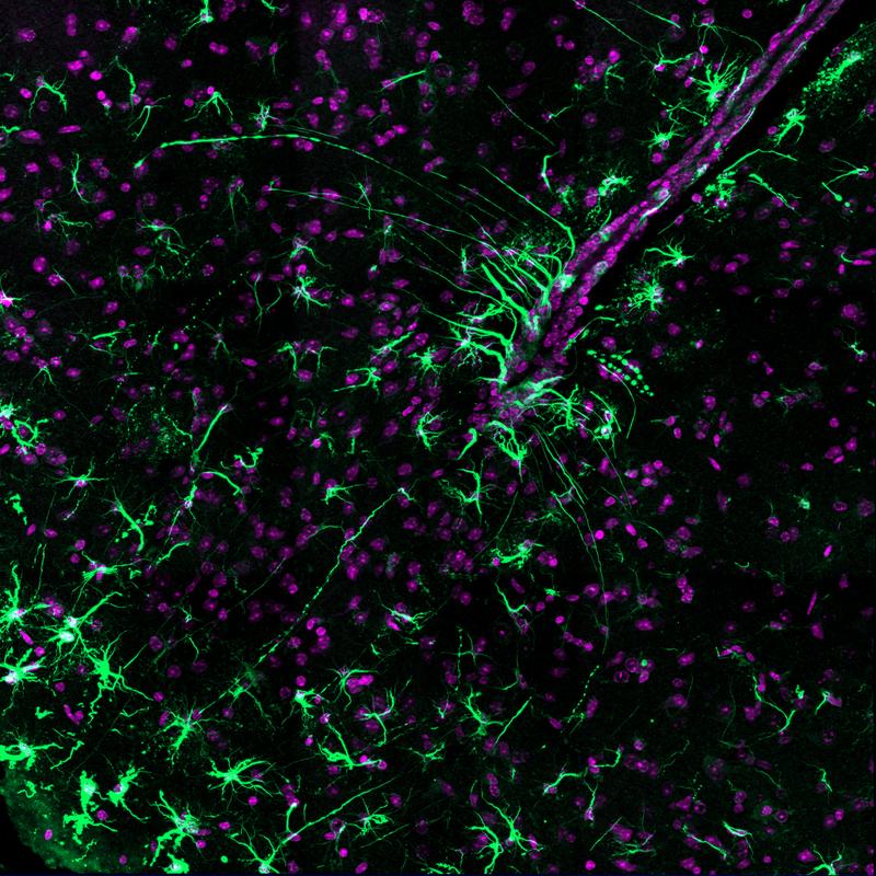 Mikroskopieaufnahme: Tanyzyten und Astrozyten grün, Zellkerne magenta. Tanyzyten und Astrozyten sind an der Verarbeitung von Lipidsignalen diesem Teil des Gehirn beteiligt.