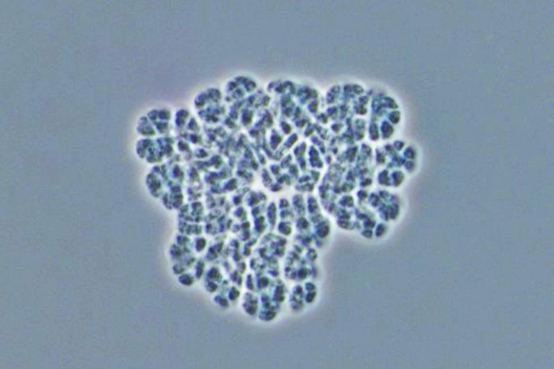 The methane-producing type of Archaea, Methanosarcina mazei, is frequently used in microbiology as a model organism.  