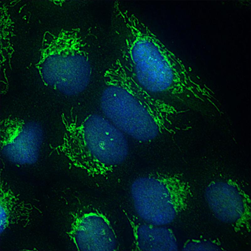 Fluoreszenz-mikroskopische Aufnahme eines Mitochondrien-Netzwerkes (grün) und des Zellkerns (blau) in einer menschlichen Zelle. 