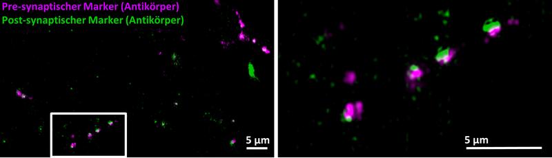 Gehirnzellen-Synapsen, mit Fluoreszenzmarkierung auf Antikörperbasis sichtbar gemacht: Pre-Synapsen (rot) und Post-Synapsen (grün) erscheinen unscharf; synaptischer Spalt ist nicht völlig aufgelöst.