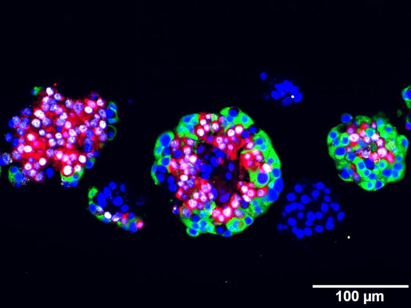 Menschliche Langerhans Inseln, mit 10 mM Artemisinin behandelt und immunofluoreszent gefärbt: Zellkern (blau), ARX (weiß), Glukagon (rot) und C-Peptid (grün) 