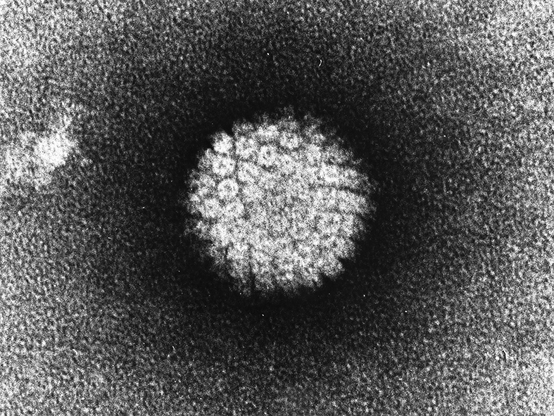 Elektronenmikroskopische Aufnahme eines Humanen Papillomvirus.