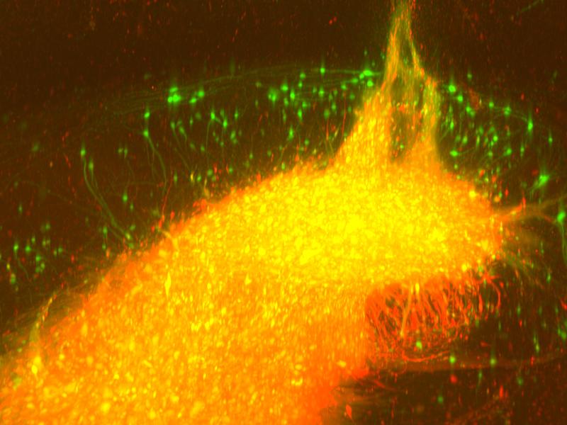 Transplantat menschlicher Nervenzellen im Hippocampus einer Maus: Umgebende Neurone im Mausgehirn haben mit den transplantierten Zellen funktionelle Verbindungen geknüpft. 