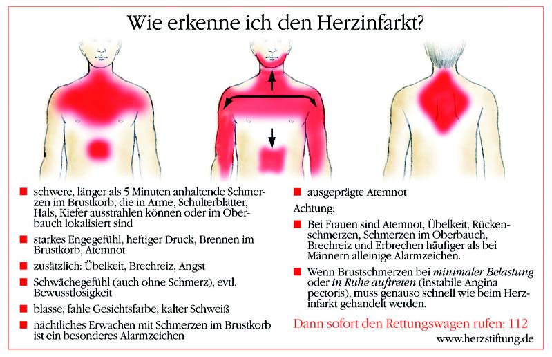 Wie erkenne ich den Herzinfarkt? Eine Darstellung der Herzinfarkt-Alarmzeichen.