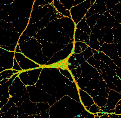 Nervenzelle, dargestellt mithilfe der 2-Photonenmikroskopie