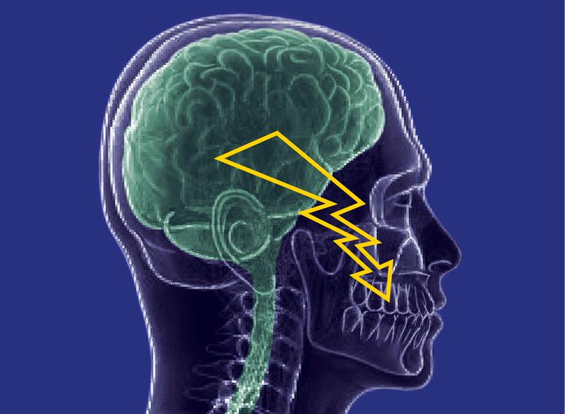 Trigeminusneuralgie: Neue Hoffnung auf eine wirksamere Schmerzlinderung. 