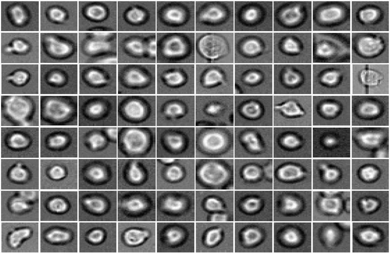 Was wohl aus ihnen wird? Blutstammzellen unter dem Mikroskop: Mit Hilfe neuer Methoden können die Helmholtz-Wissenschaftler voraussagen, wie sie sich entwickeln werden. 