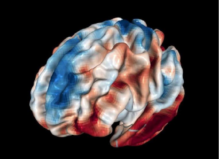 Überlagerung (ohne Bonferroni-Korrektur) eines 3D-Gehirns und der Gebiete, die eine positive Korrelation (in rot) mit Vergebung aufweisen.