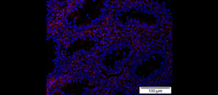 Das Protein Bcl-3 (rot) führt zu chronischen Entzündungen im Darm