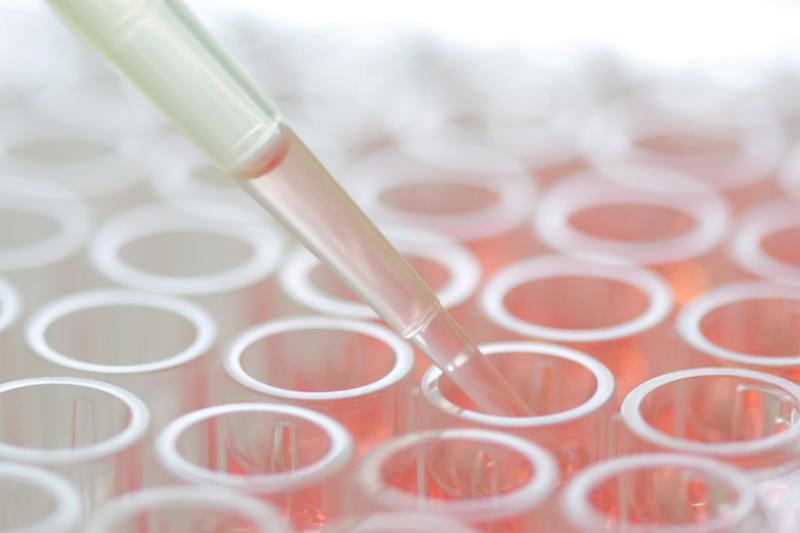 In einem neuen Forschungsprojekt wird die immuntherapeutische Krebsforschung weiter vorangetrieben