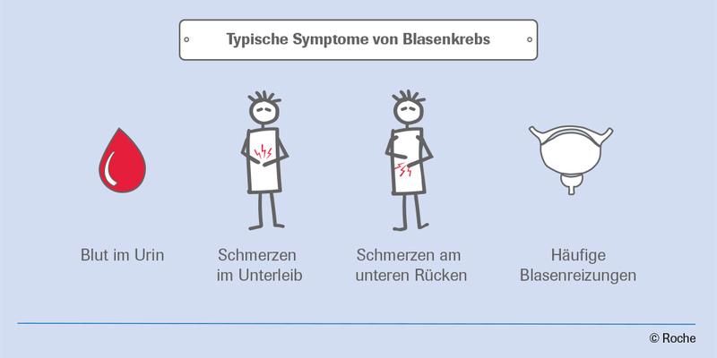 Typische Symptome von Blasenkrebs