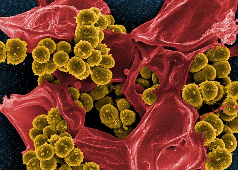 Methicillin-resistant Staphylococcus aureus (MRSA) (mustard-coloured) engulfed by a red coloured white blood cells (neutrophil granulocyte)