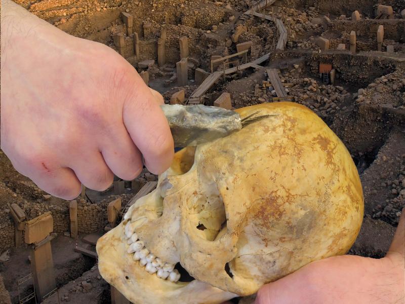 Fiktive Darstellung der Schädelmodifikation in Göbekli Tepe 