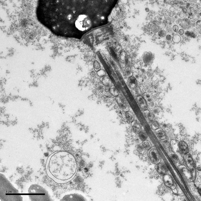  The electron-microscopic image shows a sperm cell with attached amyloid;