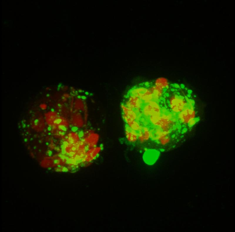 Fluorescence-microscopic image of macrophages eating sperm cell clusters that are surrounded by amyloid fibrils; 