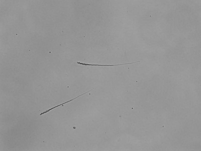 Die Spermien der Zebrafinken bestehen aus einem Kopf mit der genetischen Information, einem Mittelstück mit Mitochondrien für die Energieproduktion und einem rotierenden Schwanz.