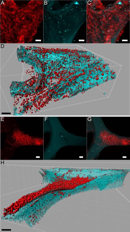 Mikroskopische Aufnahmen und darauf basierende 3d-Modelle Fluoreszenz-markierter Bakterien in einem gebrauchten Küchenschwamm (A, C, D, E, G, H; B, F Autofluoreszenz des Schwamms). 