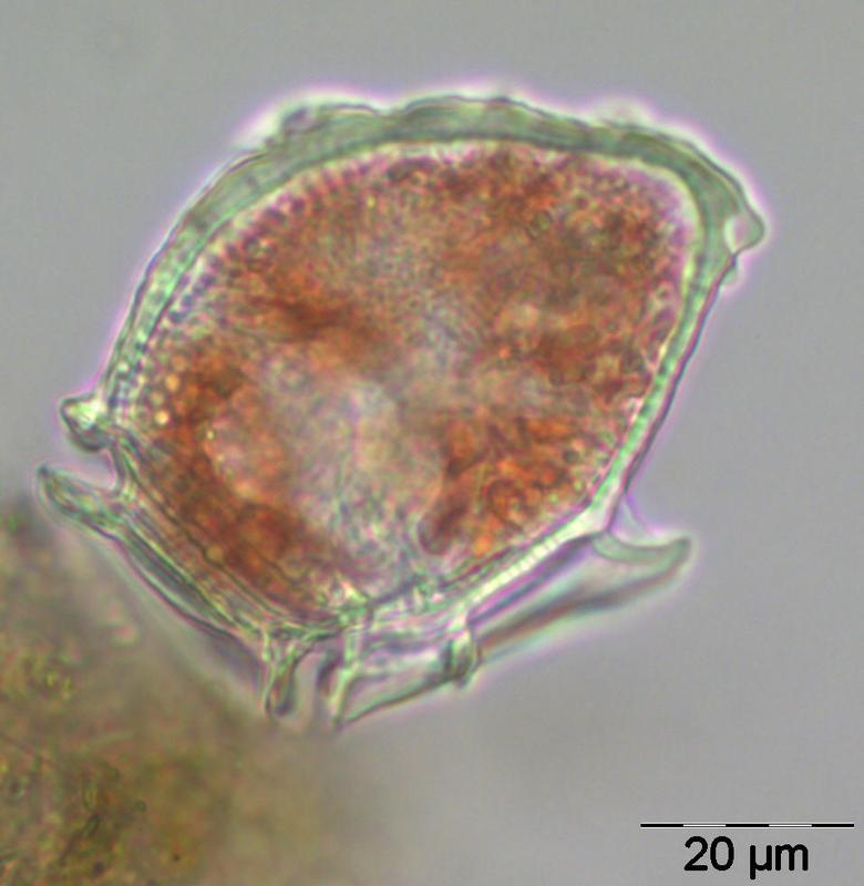 Dinoflagellat Dinophysis norvegica