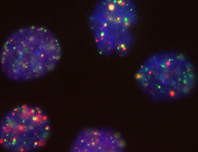 BRCA1 bei der Arbeit: Im blau eingefärbten Zellkern sind rot leuchtende BRCA1-Proteine zu sehen, die Doppelstrangbrüche im Erbgut reparieren. 