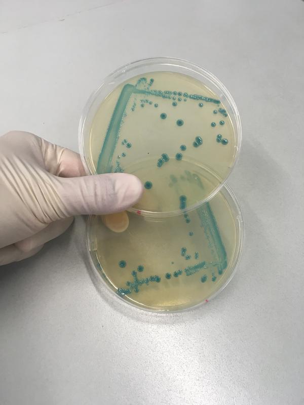Listerien sind Überlebenskünstler, den Hygienemaßnahmen in der Lebensmittelproduktion entkommen sie etwa dank einer nun identifizierten, genetischen "Stressinsel".