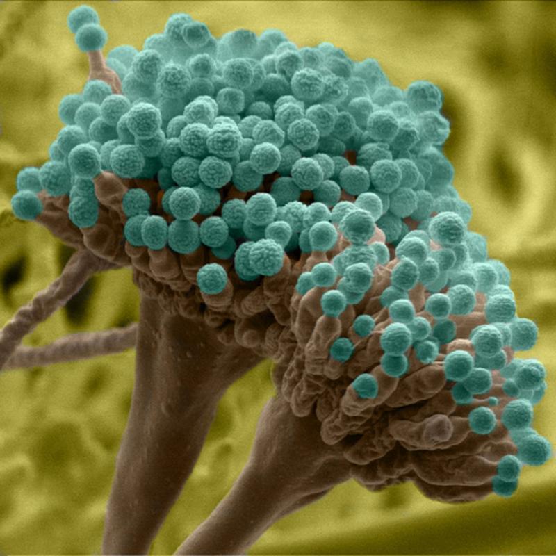 Ein Forscherteam hat herausgefunden, dass das Immunsystem des Menschen bei Pilzsporen in der Lunge eine Art Selbstmord-Mechanismus auslöst, der dazu führt, dass die Pilzsporen sich selbst zerstören. 