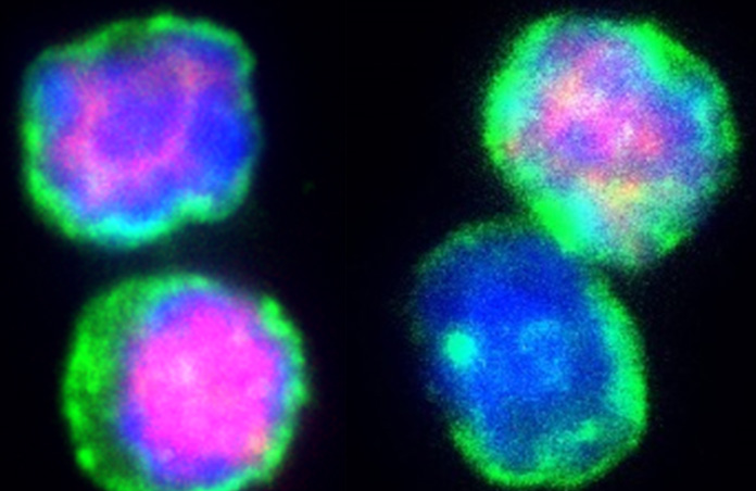 T cells after a short-term cold treatment (left) and under control conditions (right). Immunofluorescent staining of the T cell marker CD3 (green), the Treg marker Foxp3 (red) and the nucleus (blue).