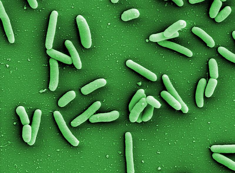 Bakterien der Art Pseudomonas aeruginosa (links) entwickeln häufig Resistenzen gegen Antibiotika und schützen sich zudem in Biofilmen vor äußeren Einflüssen.