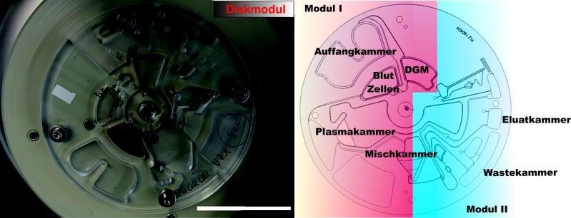 Abb. 1: Diskplattform bestehend aus Modul I und II und den Kammern für die entsprechenden Prozessschritte. Der Messbalken entspricht 5cm.