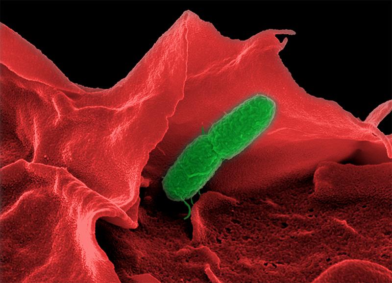 Elektronenmikroskopische Aufnahme von Salmonella enterica (serovar Typhimurium).