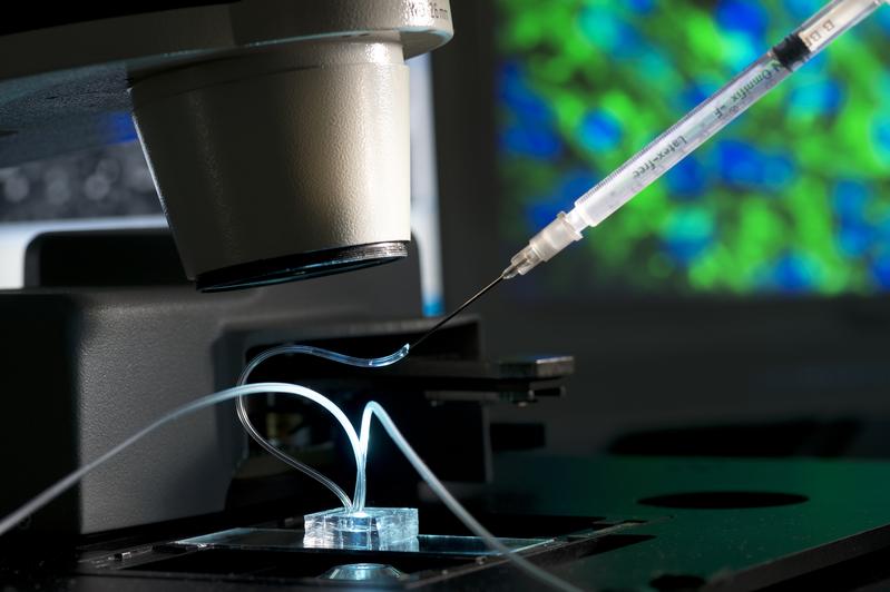 Microphysiological organ-on-a-chip system.