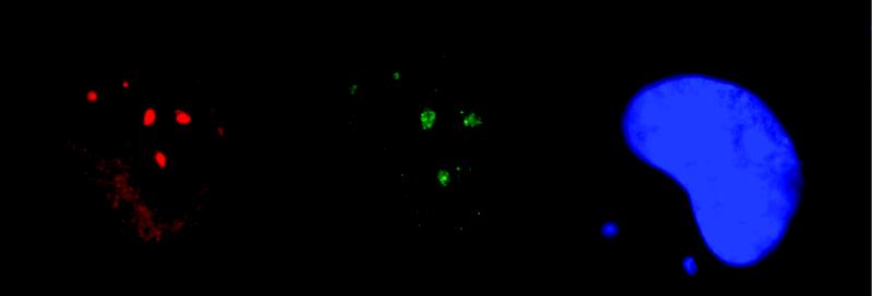 Visualisierung der DNA-Reperaturproteine XPC (grün) und MUTYH (rot) an Orten mit UV-induziertem DNA-Schaden im Zellkern (blau) einer menschlichen Zelle